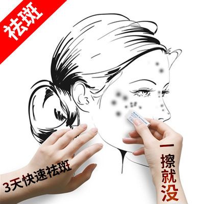 28863/快速祛斑】祛斑霜美白淡斑去黄褐斑去老年斑雀斑淡化色斑祛斑神器