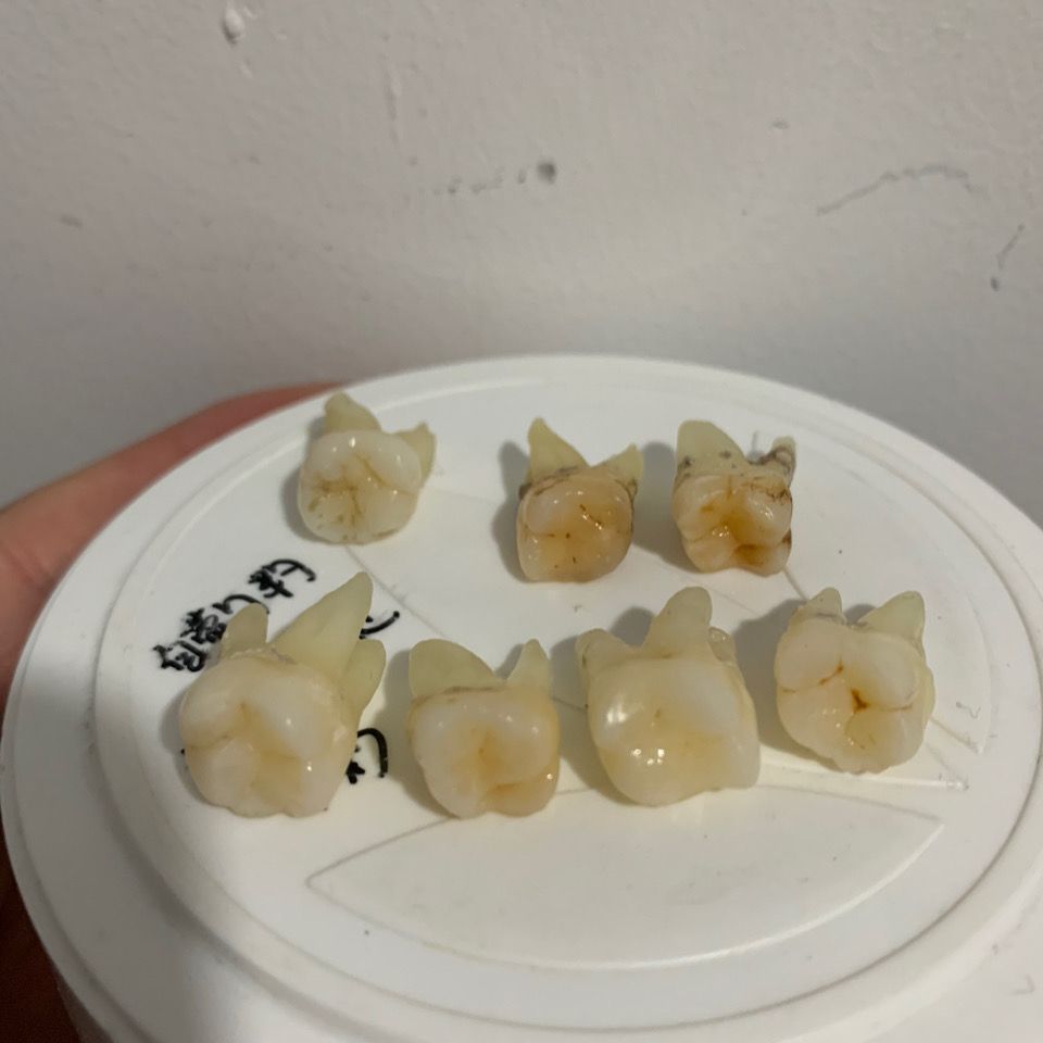 口腔离体牙真牙考试专用上6第一磨牙需要别的请咨询客服各种都有