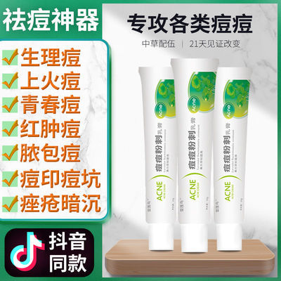 33101/抖音同款Acne痘痘粉刺膏祛痘印痘坑修复痤疮去痘痘神器草本祛痘膏