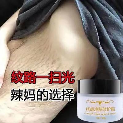 74788/去妊娠纹产后修复霜产前预防紧致肚皮去除肥胖纹生长纹疤克星孕妇