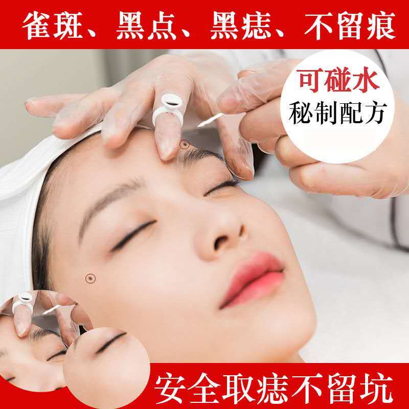 怎么让脸上长点肉肉 08e88d9d-a107-409e-96f4-a1d0189160ce.jpg