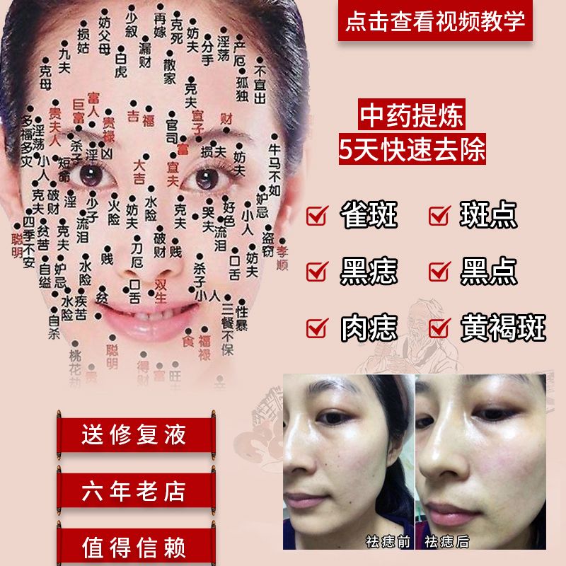 药水祛斑后痣是什么原理_药水祛斑后脱皮图片