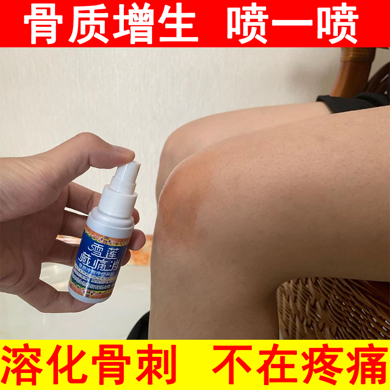 骨质增生膏药喷剂治膝盖关节骨刺药贴膏肿胀僵硬疼痛治骨痹一擦灵