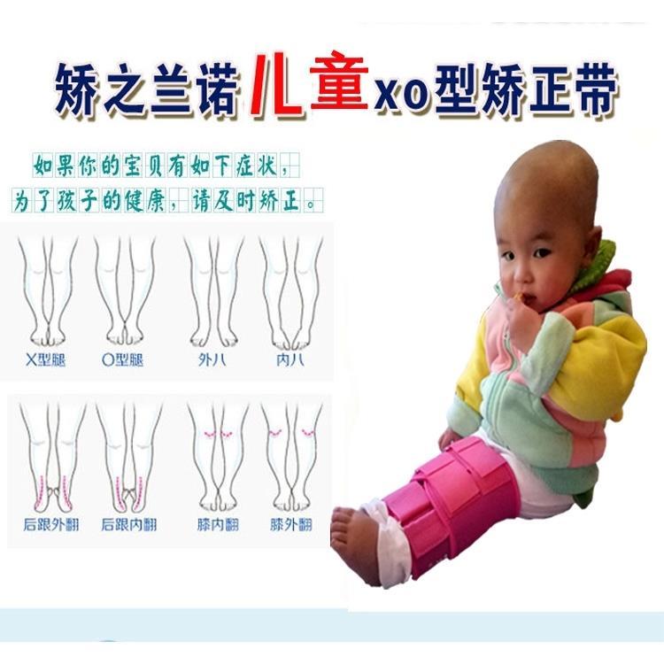 婴儿幼儿宝宝绑腿带o型腿矫正器儿童腿型x型腿矫正带xo内八字