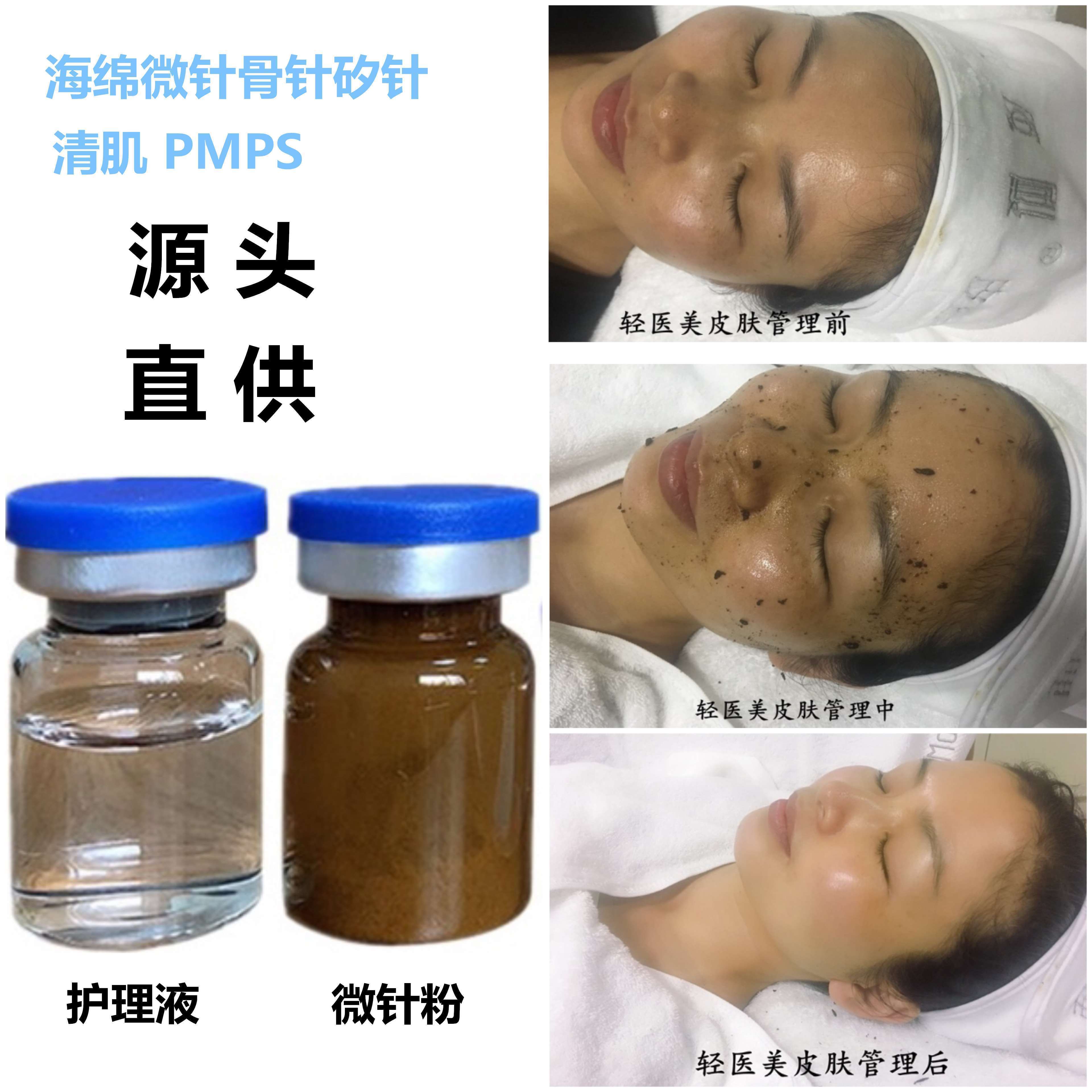 源头pmps海绵微针粉骨针植物微针粉海藻矽针轻医美骨针清洁批 发